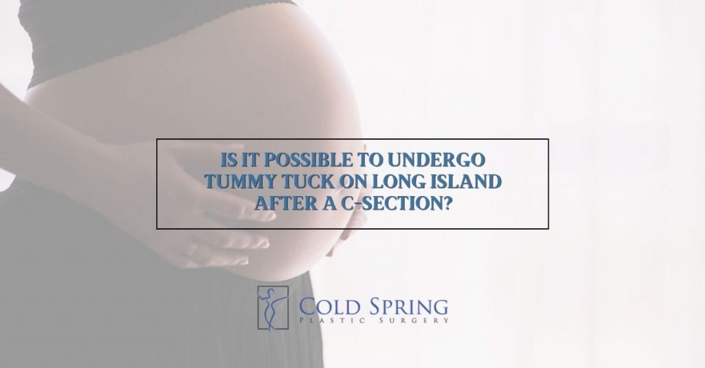 tummy tuck on Long Island